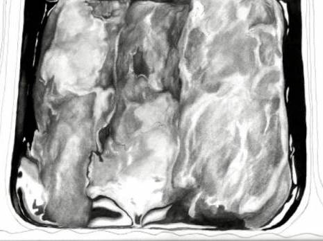 Les règles élémentaires d'hygiène sont souvent négligées