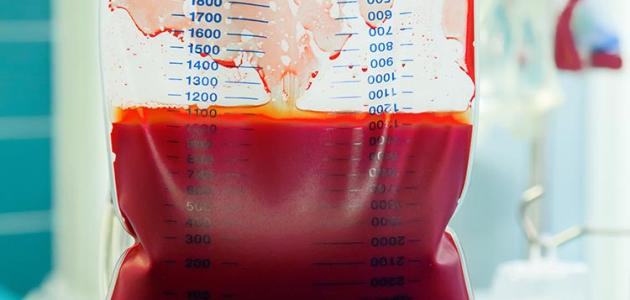 علاج الانيميا