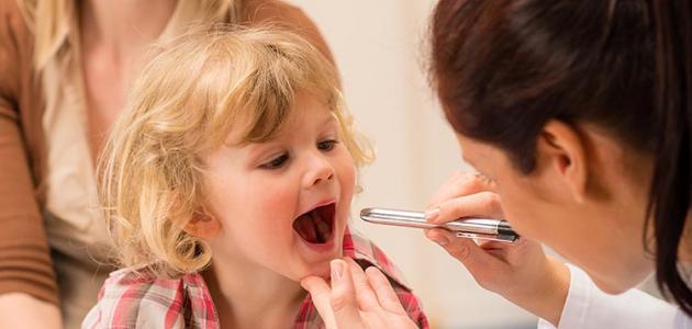 علاج إلتهاب الحلق