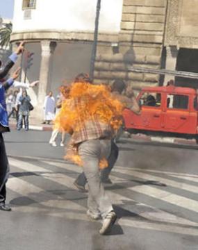 Le syndrome de tiaret