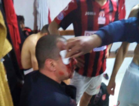 عشرون جريح بسبب أعمال عنف خلال مباراة مولودية بجاية - اتحاد العاصمة