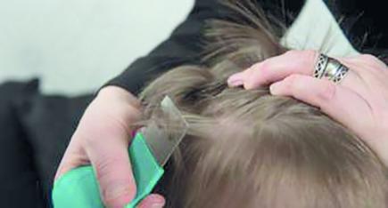 برقية عاجلة لمدراء التربية للتأكد من انتشار القمل بمدارس العاصمة