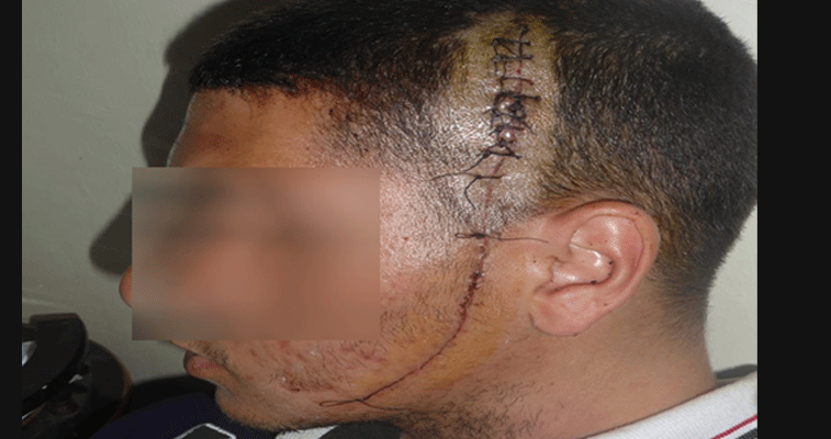 عامان حبسا لمعتد على تلميذ ثانوي بسكين على مستوى الوجه بباتنة