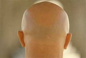 الرجال البيض قصيرو القامة... أنتم معرّضون للصلع اكثر من غيركم!