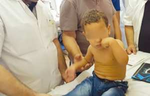 Des enfants opérés de paralysie du plexus brachial à l'hôpital de Ben Aknoun