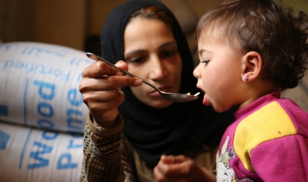 نصف سكان العالم سيعانون سوء التغذية بحلول 2050