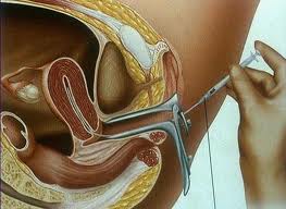 العاصمة.. مخبر لمراقبة وصيانة الأعضاء الاصطناعية السمعية قريبا