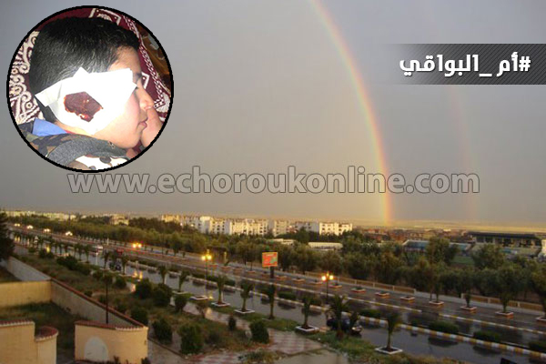 مشرفة تربوية تعتدي على تلميذ بأم البواقي وتفقده السمع