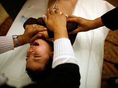 Gare aux circoncisions de masse Des recommandations sanitaires à respecter pour éviter les risques