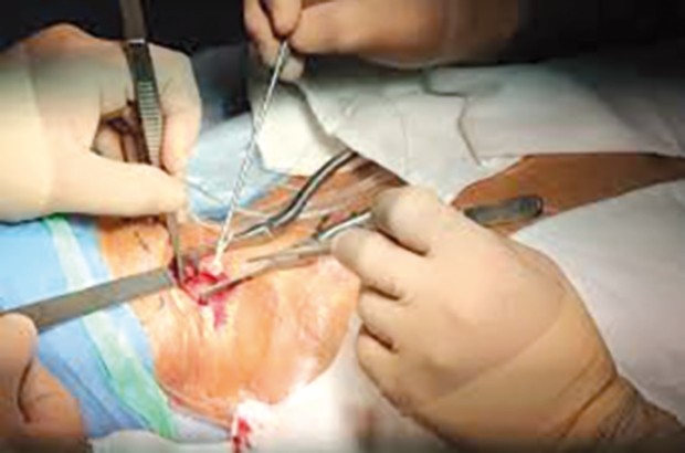 L'échocardiographie pédiatriqueet congénitale en débat à Sétif