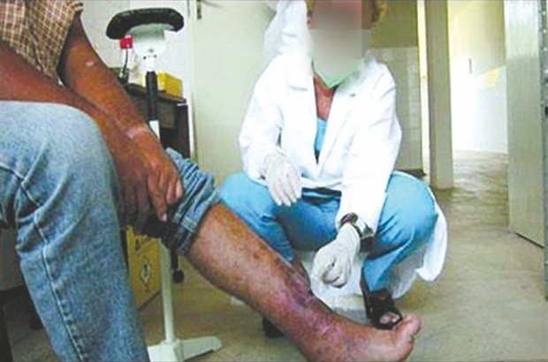 Plus de 2 000 cas enregistrés depuis le début de l'année