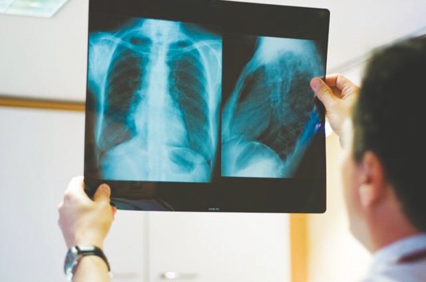 Déficit important en radiologues