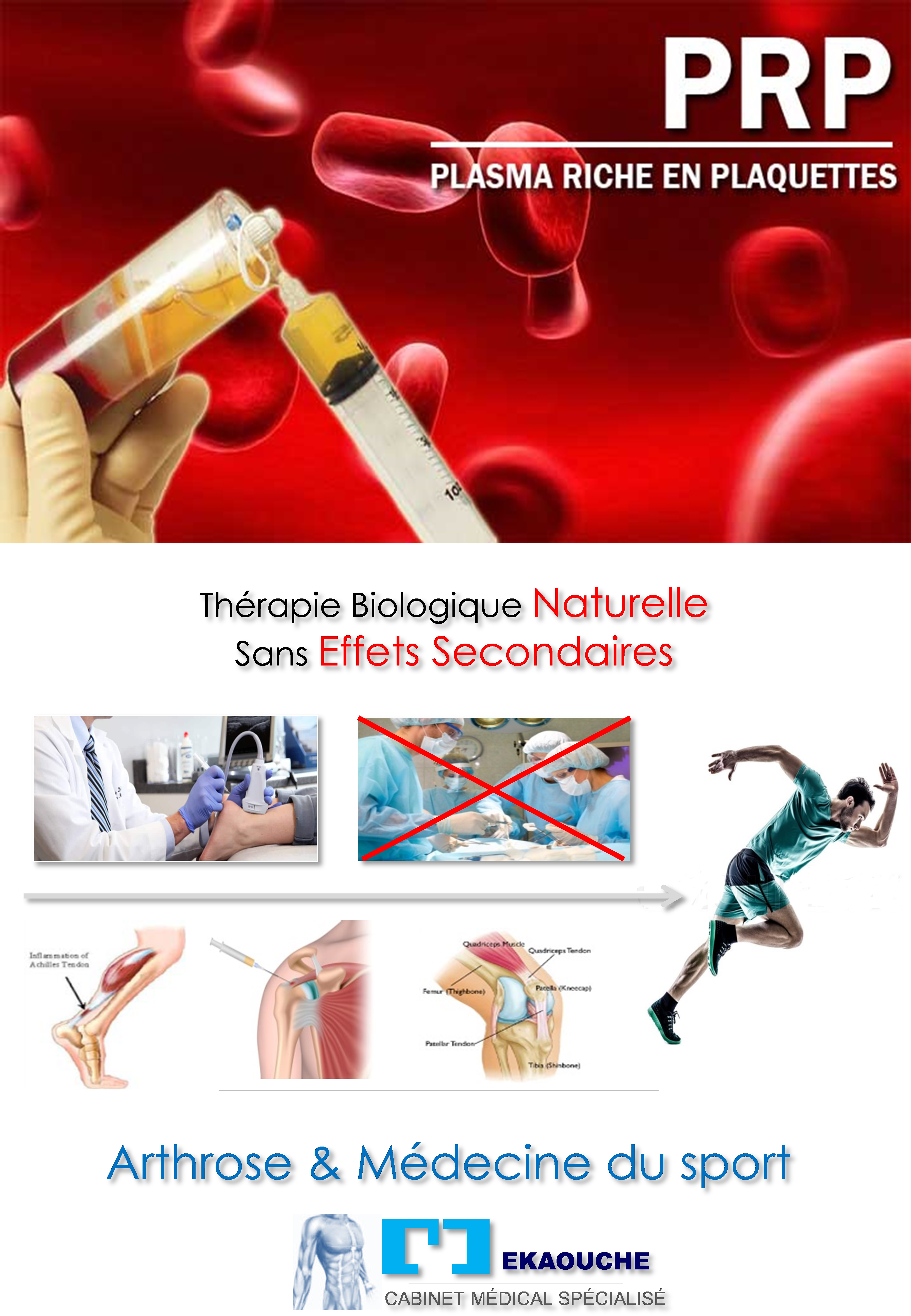 Plasma Riche en Plaquettes