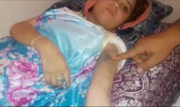 عائلة من غليزان تناشد وزير الصحة لإجراء عملية مستعجلة في زرع الكلى لابنتها