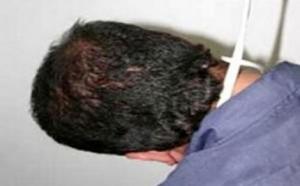 ينتحر حزنا على وفاة زوجته الأولى في الطارف