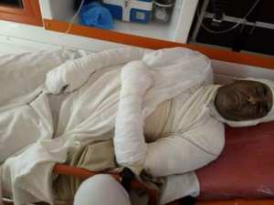 كهل يضرم النار في جسده بعين بوسيف بالمدية