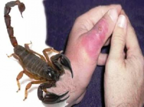 أدرار : تسجيل أزيد من 1.800 حالة لسع عقربي منها 6 حالات مميتة منذ بداية 2017