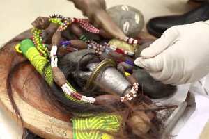 مشعوذان ببسكرة يدعيان القدرة على علاج السرطان