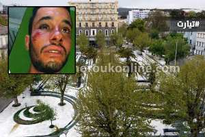 طبيب أسنان يبرح زبونا ضربا بتيارت لأنه رفض التسديد