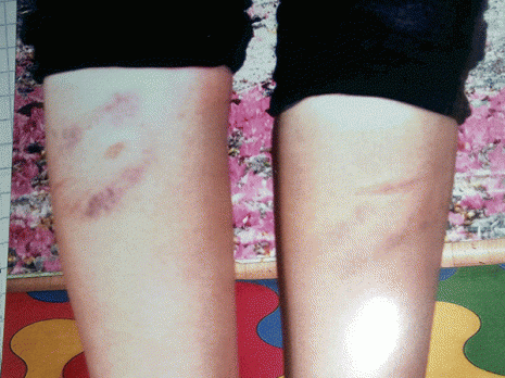 Une collégienne victime d'une agression physique...