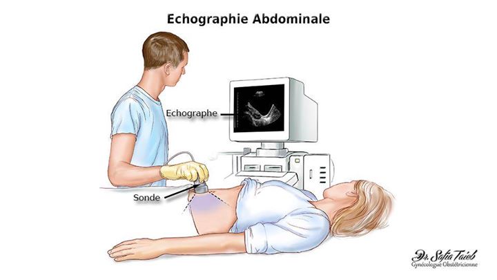 Formation Echographie Générale