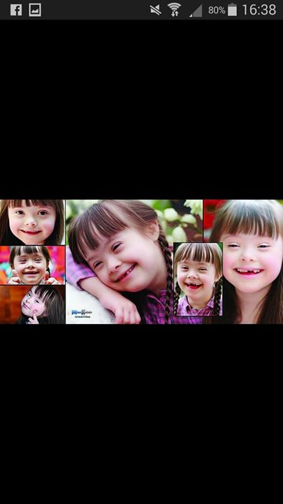 فرحتنا معاكم تكمل ( متلازمة داون )