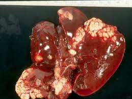 Algérie - 380 cas sont enregistrés annuellement: Le kyste hydatique continue d’inquiéter les pouvoirs publics