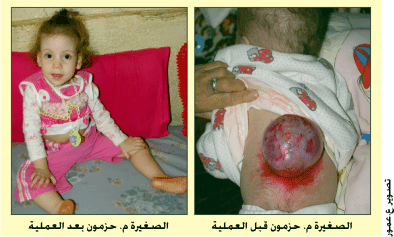 بعد أن هب القراء لمساعدتها في إجراء عملية جراحية بمدينة سطيف