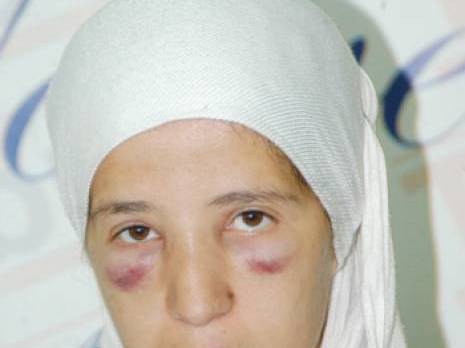 La journaliste Hanane Driss violentée par un policier                                    Acharnement contre les hommes et les femmes de la presse