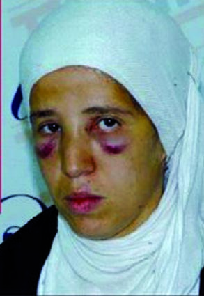 Les agents de police sanctionnés                                    Agressions de reporters de presse