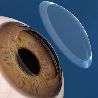 فريق طبي متخصص يجري أول عمليتين جراحيتين لزرع القرنية بالجنوب                                    من مستشفى فرنس فانون بالبليدة