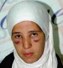 Sévères sanctions contre les policiers ayant agressé deux journalistes