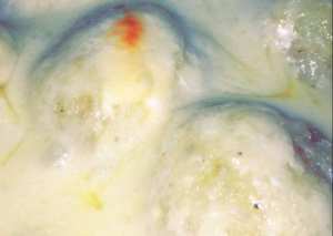 كُرات البطاطس بالدجاج