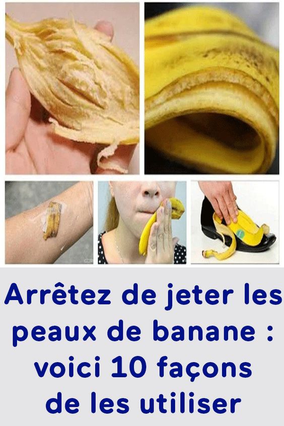 Arrêtez de jeter les peaux de banane : voici 10 façons de les utiliser