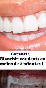 Garanti : Blanchir vos dents en moins de 2 minutes !
