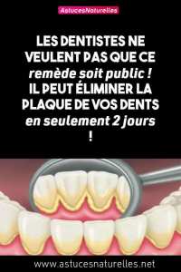 Les dentistes ne veulent pas que ce remède soit public ! Il peut éliminer la plaque de vos dents en seulement 2 jours !