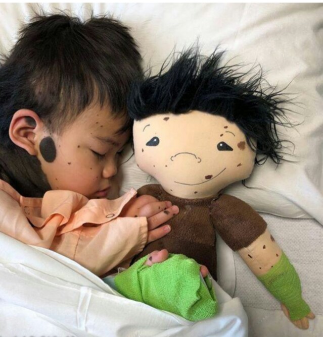 Cette maman crée des poupées personnalisées pour les enfants porteurs d'un handicap