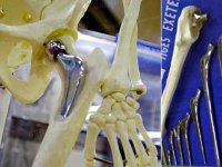 « L'Algérie n'est pas concernée », affirment les praticiens de la santé Affaire des prothèses de hanche défectueuses en France