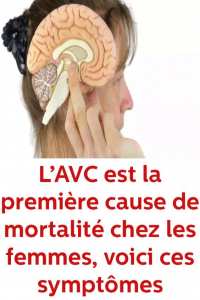 L’AVC est la première cause de mortalité chez les femmes, voici ces symptômes