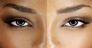 Blanchir la peau avec un éclaircissant naturel.