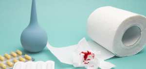 علاج البواسير