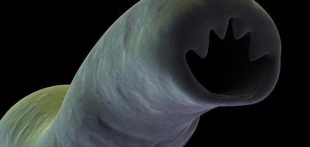 علاج الديدان