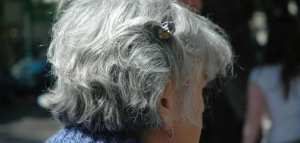 علاج الشيب المبكر