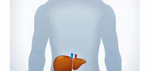 علاج تليف الكبد