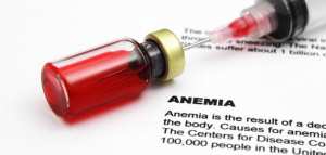 علاج فقر الدم
