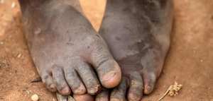 أسباب الفقر