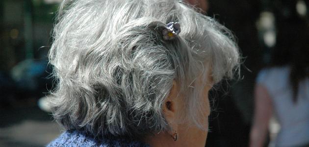 علاج الشيب المبكر