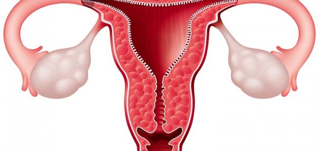 علاج ضعف المبايض