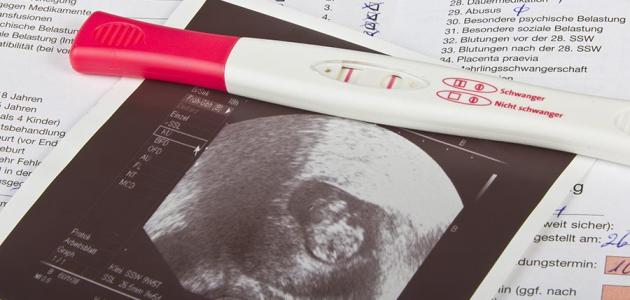 العلامات الأولية للحمل