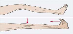 ما هو علاج شد العضل